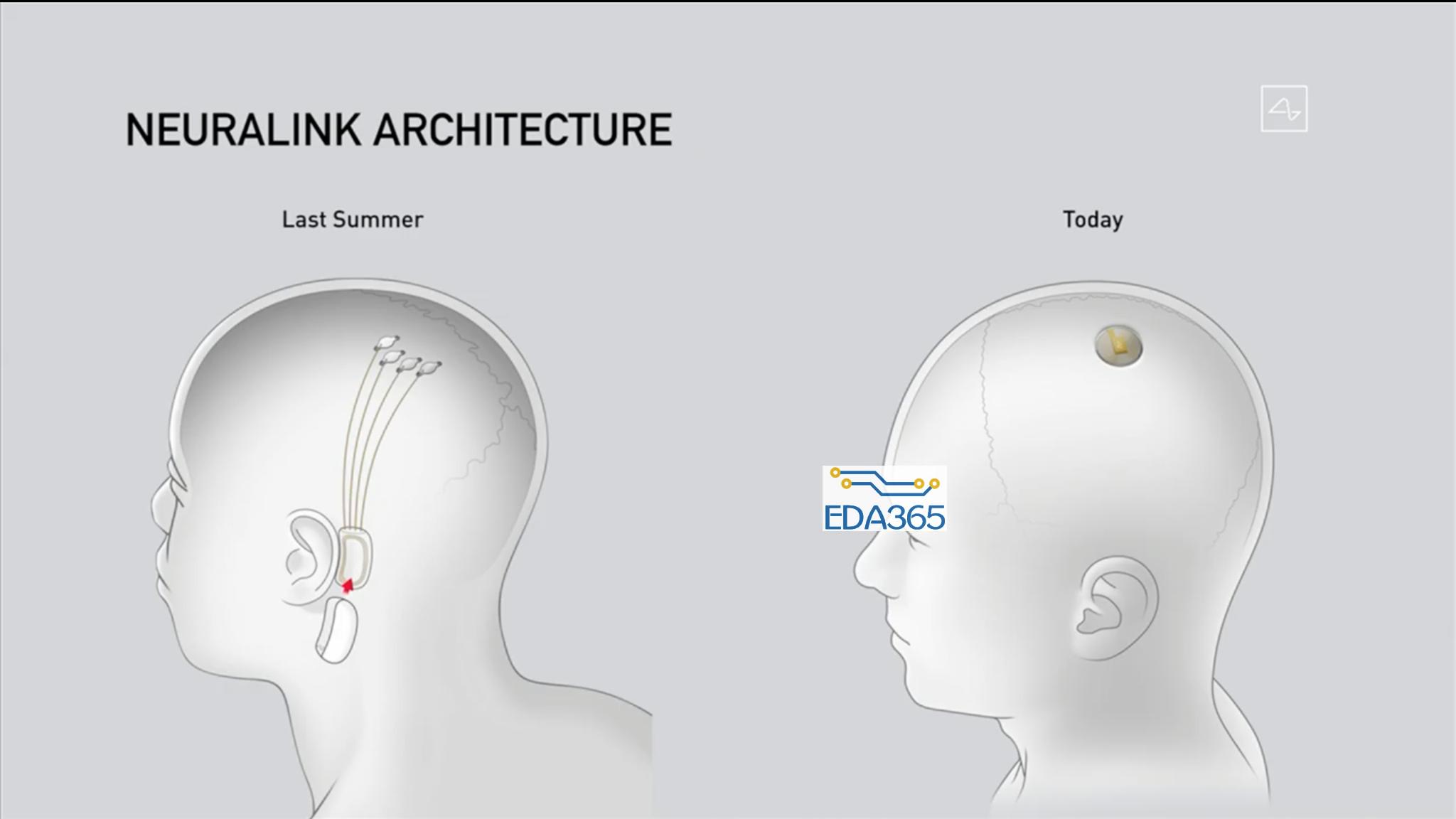  2019年展示的设备位于耳后（左），右侧为最新设备